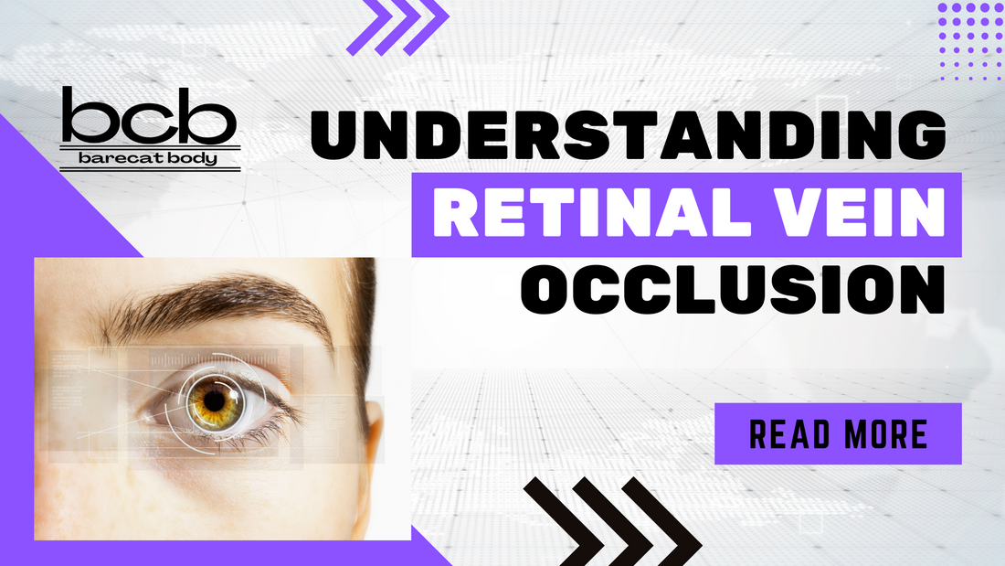 Understanding Retinal Vein Occlusion: Causes, Prevention, and Natural Remedies for CRVO