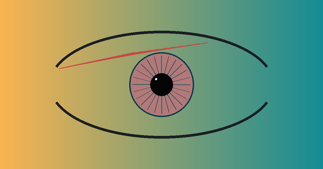 The Scary Truth About High Eye Pressure (And How to Lower It Naturally)