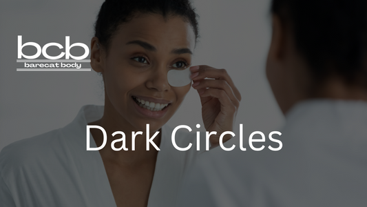 30 Ways to reduce or remove dark eye circles