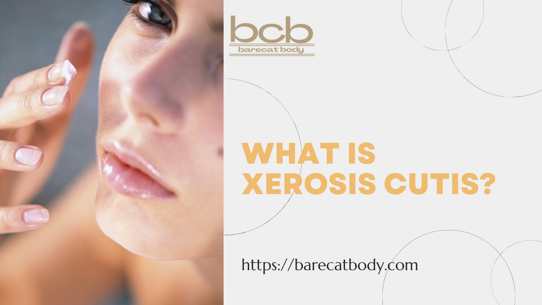 What is xerosis cutis?