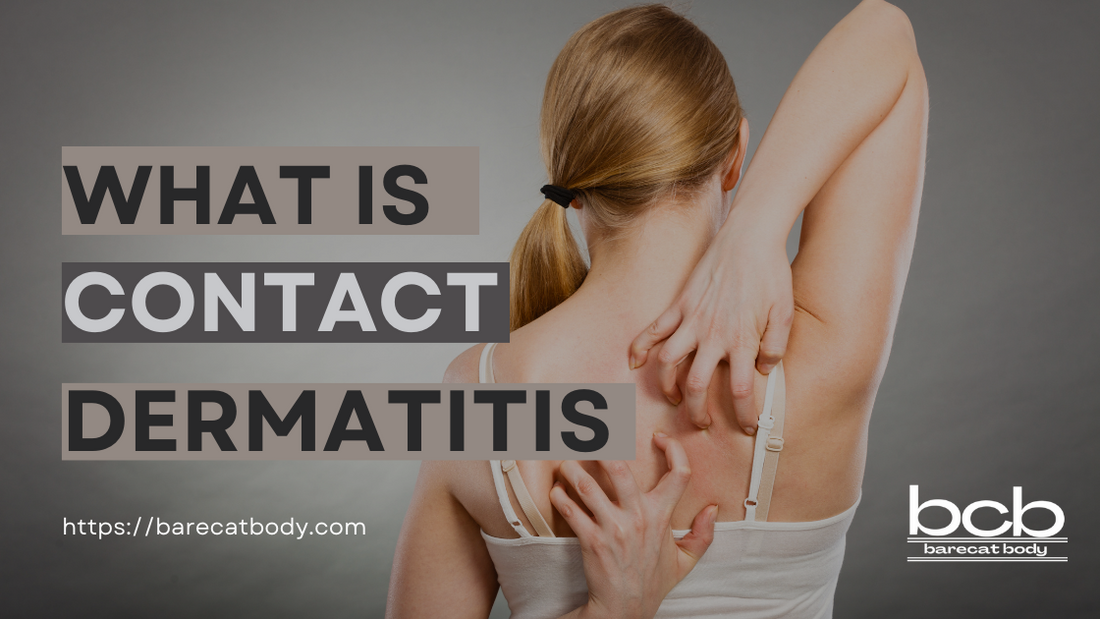 What is Contact Dermatitis?